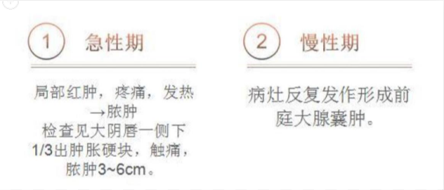 阴道炎3.png