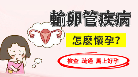 输卵管1.jpg